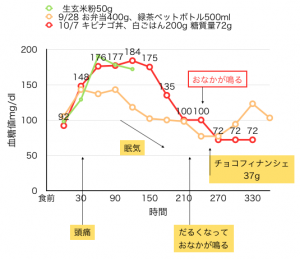 10-7血糖値測定［05］キビナゴ丼（白飯200g）